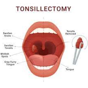 best-ent-doctore-surat